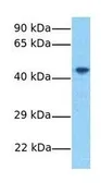 Anti-FAM175B antibody, Internal used in Western Blot (WB). GTX45284