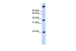 Anti-SSBP3 antibody, Internal used in Western Blot (WB). GTX45295