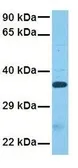Anti-VGLL3 antibody, Internal used in Western Blot (WB). GTX45296