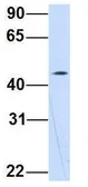 Anti-WDSOF1 antibody, N-term used in Western Blot (WB). GTX45310