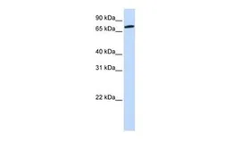 Anti-COG4 antibody, Internal used in Western Blot (WB). GTX45312