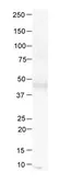 Anti-METAP1 antibody, N-term used in Western Blot (WB). GTX45324