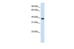 Anti-GPD1L antibody, Internal used in Western Blot (WB). GTX45325