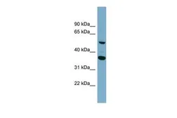 Anti-ADAMDEC1 antibody, Internal used in Western Blot (WB). GTX45338