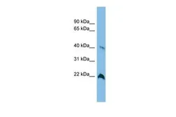 Anti-TGDS antibody, Internal used in Western Blot (WB). GTX45345