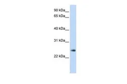 Anti-THYN1 antibody, Internal used in Western Blot (WB). GTX45348