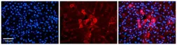 Anti-METTL5 antibody, N-term used in IHC (Paraffin sections) (IHC-P). GTX45350