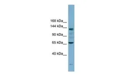 Anti-IARS antibody, N-term used in Western Blot (WB). GTX45355