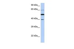 Anti-PNMA3 antibody, N-term used in Western Blot (WB). GTX45357