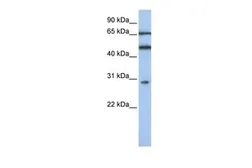 Anti-IFIT5 antibody, N-term used in Western Blot (WB). GTX45363