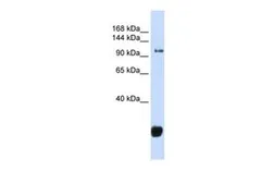 Anti-FBXO10 antibody, Internal used in Western Blot (WB). GTX45367