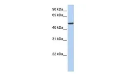 Anti-PHLDA1 antibody, Internal used in Western Blot (WB). GTX45378