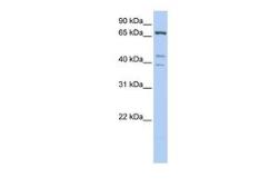 Anti-IPP antibody, C-term used in Western Blot (WB). GTX45380