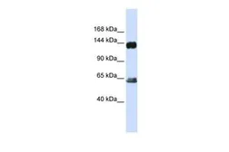 Anti-C3G antibody, C-term used in Western Blot (WB). GTX45384