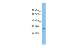 Anti-C1orf104 antibody, Internal used in Western Blot (WB). GTX45403