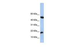 Anti-LOC285033 antibody, N-term used in Western Blot (WB). GTX45407