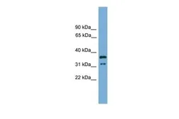 Anti-KCTD21 antibody, Internal used in Western Blot (WB). GTX45413