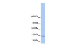 Anti-LOC284009 antibody, N-term used in Western Blot (WB). GTX45416