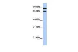 Anti-C9ORF117 antibody, N-term used in Western Blot (WB). GTX45427