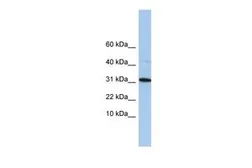 Anti-C9ORF153 antibody, Internal used in Western Blot (WB). GTX45430