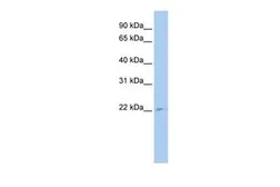 Anti-TUSC1 antibody, Internal used in Western Blot (WB). GTX45435