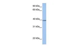 Anti-AMT antibody, N-term used in Western Blot (WB). GTX45441