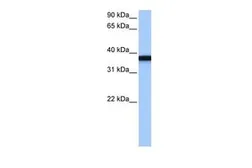 Anti-GSG1 antibody, C-term used in Western Blot (WB). GTX45446