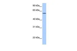 Anti-ACSBG2 antibody, Internal used in Western Blot (WB). GTX45456