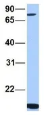 Anti-ARHGAP28 antibody, C-term used in Western Blot (WB). GTX45457