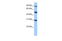 Anti-C17ORF39 antibody, C-term used in Western Blot (WB). GTX45462