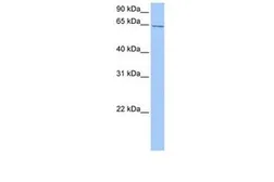 Anti-C2ORF42 antibody, C-term used in Western Blot (WB). GTX45468