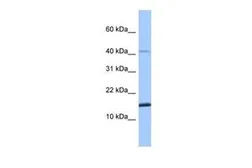 Anti-SPAG11B antibody, N-term used in Western Blot (WB). GTX45472