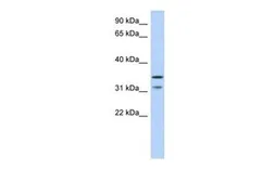 Anti-C17orf81 antibody, Internal used in Western Blot (WB). GTX45475