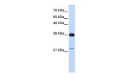 Anti-TP53TG5 antibody, Internal used in Western Blot (WB). GTX45476