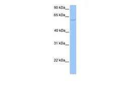 Anti-CCT6B antibody, N-term used in Western Blot (WB). GTX45480