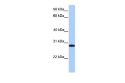 Anti-CDKN3 antibody, C-term used in Western Blot (WB). GTX45484