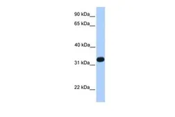 Anti-ACRV1 antibody, N-term used in Western Blot (WB). GTX45490