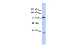 Anti-AP2B1 antibody, Internal used in Western Blot (WB). GTX45494