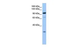 Anti-AP2B1 antibody, C-term used in Western Blot (WB). GTX45495