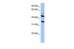 Anti-IL13 Receptor alpha 2 antibody, Internal used in Western Blot (WB). GTX45499