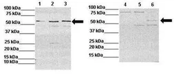 Anti-IL13 Receptor alpha 2 antibody, N-term used in Western Blot (WB). GTX45500