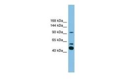Anti-PLA2G4E antibody, C-term used in Western Blot (WB). GTX45501