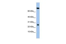 Anti-ZSWIM3 antibody, N-term used in Western Blot (WB). GTX45506