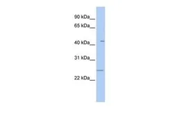 Anti-FAM173B antibody, N-term used in Western Blot (WB). GTX45520