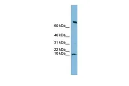 Anti-C1orf122 antibody, N-term used in Western Blot (WB). GTX45522