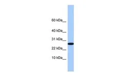 Anti-FAM101A antibody, Internal used in Western Blot (WB). GTX45535