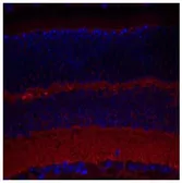 Anti-SYT9 antibody, Internal used in IHC (Paraffin sections) (IHC-P). GTX45560