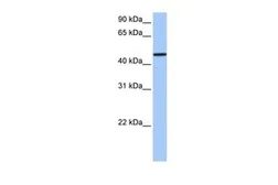 Anti-SAMD14 antibody, N-term used in Western Blot (WB). GTX45562