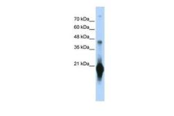 Anti-C17ORF49 antibody, Internal used in Western Blot (WB). GTX45566