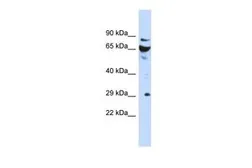 Anti-DCUN1D3 antibody, N-term used in Western Blot (WB). GTX45583